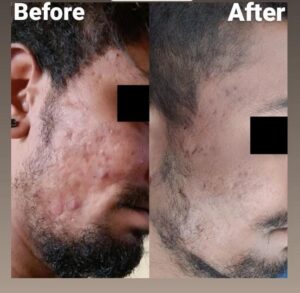 before after (1)